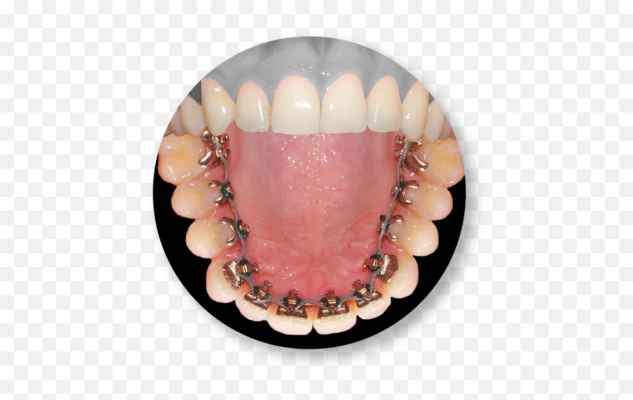 Dr Isaak Yelizar Orthodontist In Rego Park Ny - Jaw Png,Braces Png