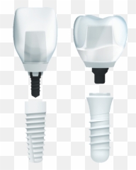 Zeramex Ceramic Dental Implants The Oaks Center - Incandescent Light Bulb png