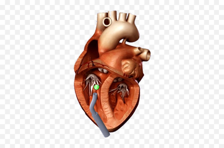 Fileheartpng - Paul Thienphrapa 3d Heart Model,Orange Heart Png