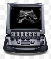 Products Jnc International Limited Medical Equipment - Sonosite Turbo png