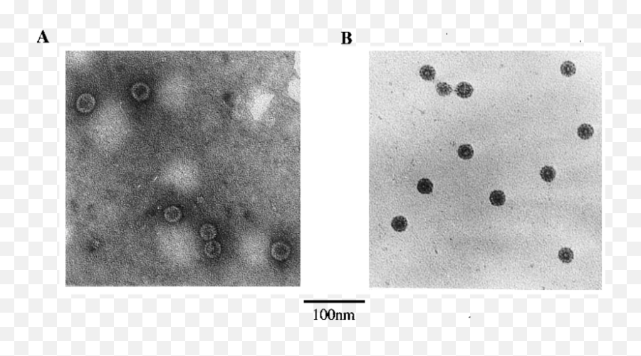 Electron Micrograph Of Hbc Particles A Fme1 - Hbc Monochrome Png,Particles Png
