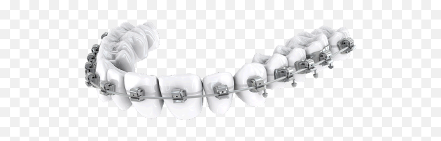 Orthodontics Treatment Dental Hero North Macedonia - Bracelet Png,Braces Png