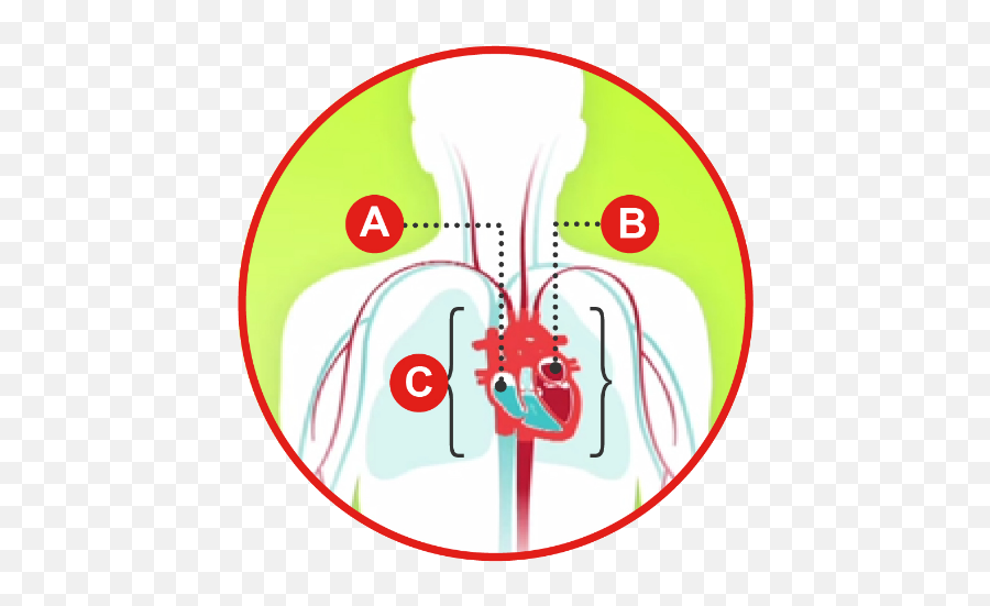 Types Of Heart Failure American Association - Insuficiencia Cardiaca Tipos Png,Blood Circulation Icon