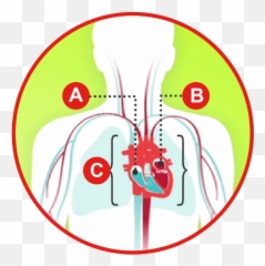Types Of Heart Failure American Association - Insuficiencia Cardiaca Tipos png