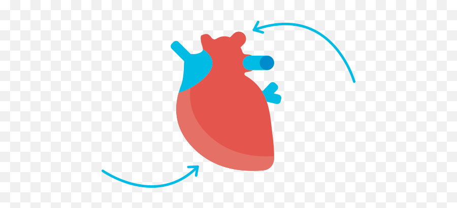 A Simple Guide To Heart Failure Hf Itu0027s Causes And - Clip Art Png,Failure Png