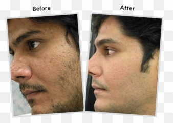 The Esthetic Clinics - Best Plastic u0026 Cosmetic Surgery For Adult png
