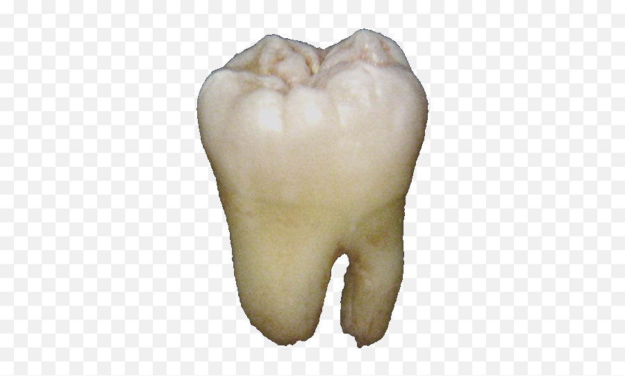 Lower Wisdom Tooth - Tooth Png,Tooth Png