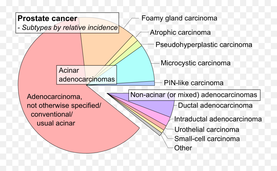 Fileprostate Cancer Typespng - Wikipedia Prostate Cancer Types,Lilac Png