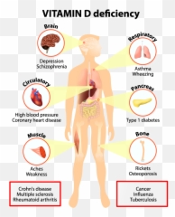 Important Signs - Disease Caused By Vitamin Deficiency png