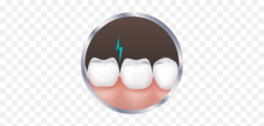 Is It A Cavity Or Sensitive Teeth Sensodyne - Cosmetic Dentistry Png,Icon Tooth Treatment