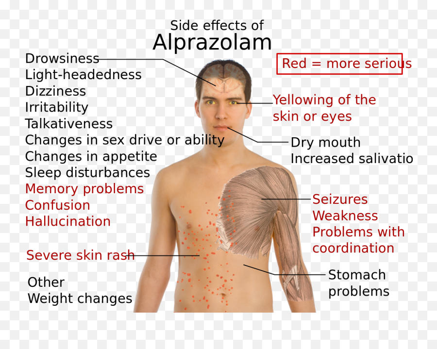 Side Effects Of Alprazolam - Xanax Side Effects Rash Png,Xanax Png