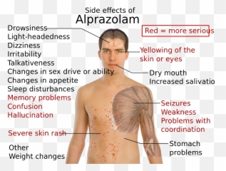 Side Effects Of Alprazolam - Xanax Side Effects Rash Png,Xanax Png