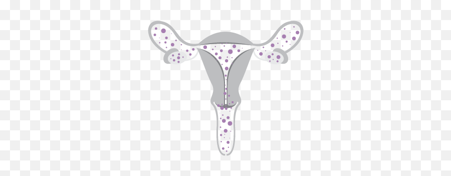 Uterineendometrial U2013 Foundation For Womenu0027s Cancer - Illustration Png,Uterus Png