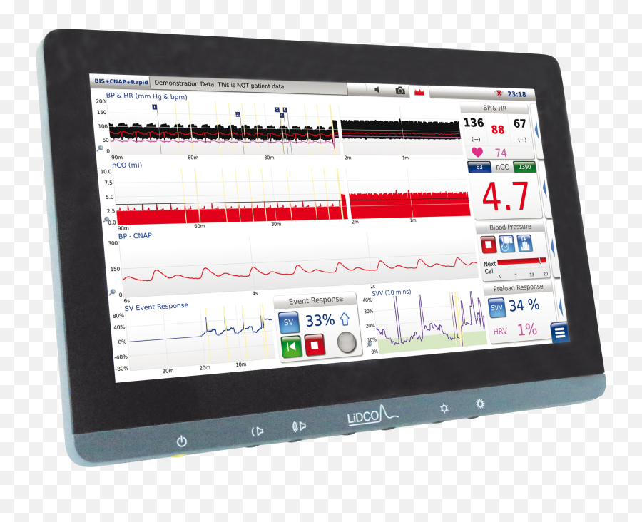 New Monitor Transparent Background Lidco U2013 Hemodynamic - Lidco Hemodynamic Monitoring Png,Linkedin Logo Png Transparent Background