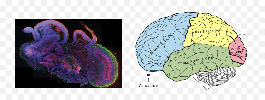 A Human Brain Model In Petri Dish U2013 Global Health News Wire - Lobes Of The Brain Png,Human Brain Png