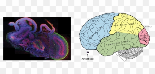 A Human Brain Model In Petri Dish U2013 Global Health News Wire - Lobes Of The Brain Png,Human Brain Png