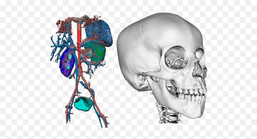 Pmri - Parametric Mri Medical Imaging Software Philadelphia Skull Png,3d Skull Png