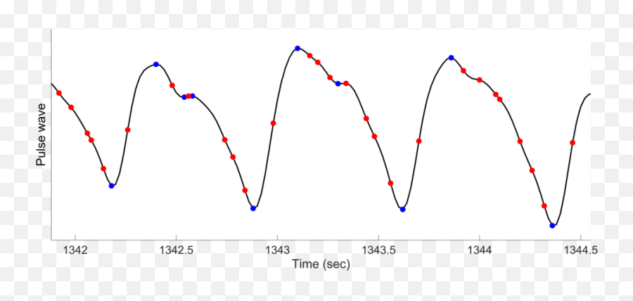 Of A Blood Pulse Wave As Seen From - Diagram Png,As Seen On Png