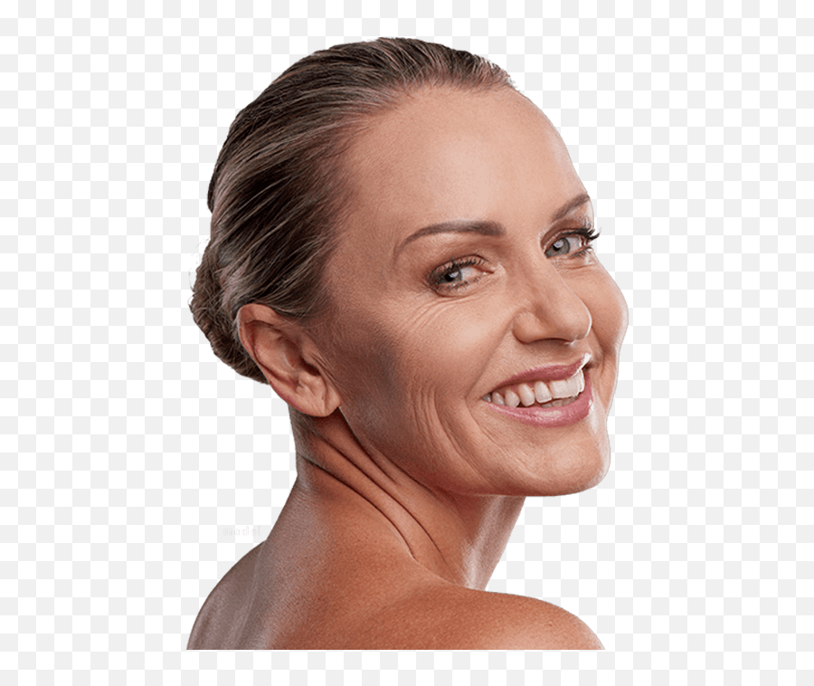Brow Lift Endoscopic Cape Cod Forehead - Girl Png,Angry Eyebrows Png