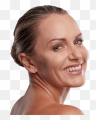 Brow Lift Endoscopic Cape Cod Forehead - Girl png