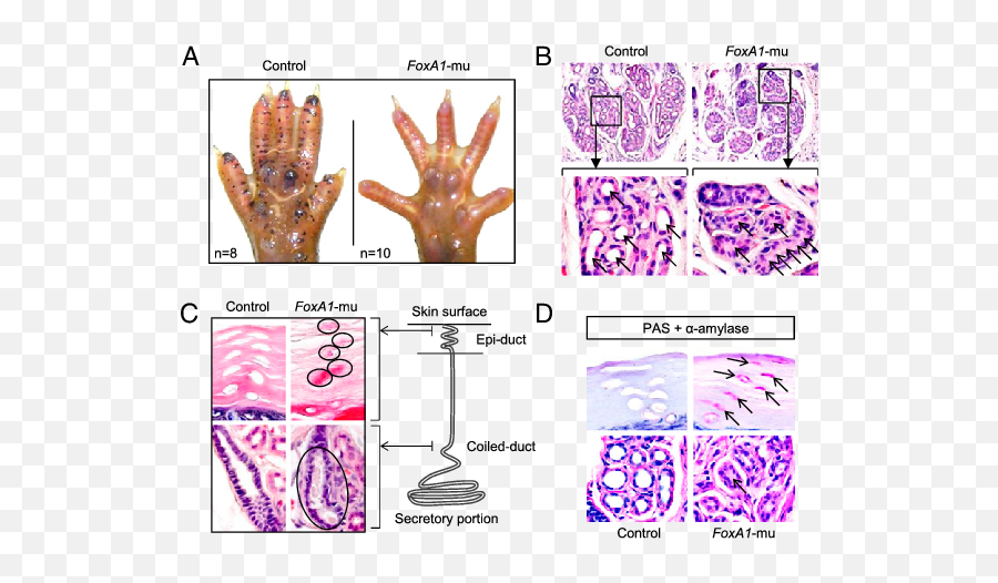 Foxa1 Knockout Causes Anhidrosis In Mice With Accumulation - Echinoderm Png,Sweat Drop Png