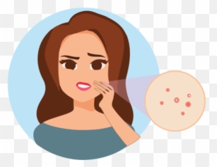 Getting To Know The Concept Of Ayurveda For Acne Is - Cartoon Pimple Acne Transparent Png,Pimple Png