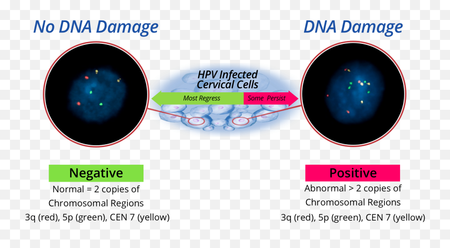 Role Of Hpv U0026 Dna Damage In Cervical Cancer Neodiagnostix - Cervical Cancer Dna Png,Dna Transparent