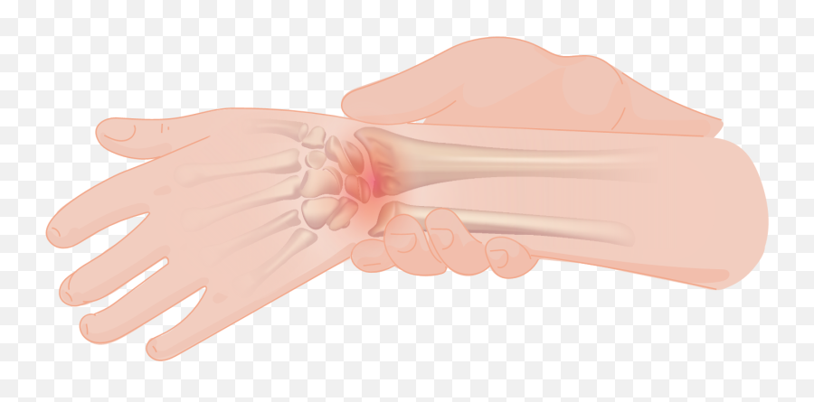 Wrist Pain - Art Png,Pain Png