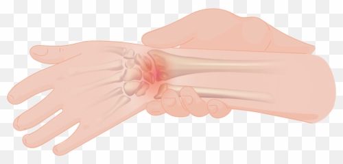 Wrist Pain - Art Png,Pain Png