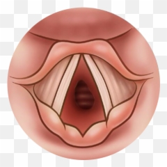 Pediatirc Tracheostomy Handbook Patient And Family - Ugly Png,Jawbone Icon Charger Replacement