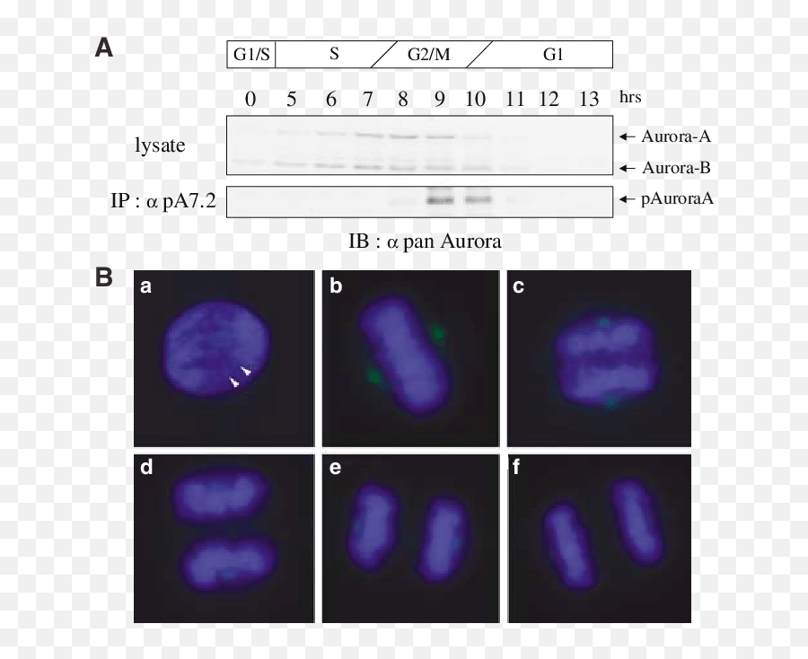 Restricted Thr288 Phosphorylation Of Human Aurora - A During Fluorescence Intensity Immunofluorescence Png,Aurora Transparent