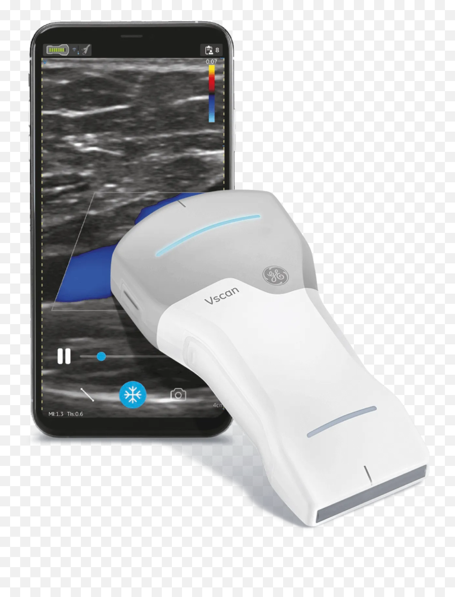 Vscan - Ge Healthcare Portable Handheld Ultrasound Ge Vscan Air Png,Lumia Icon Camera Comparison