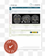 Icobrain Product Overview Icometrix - Language png