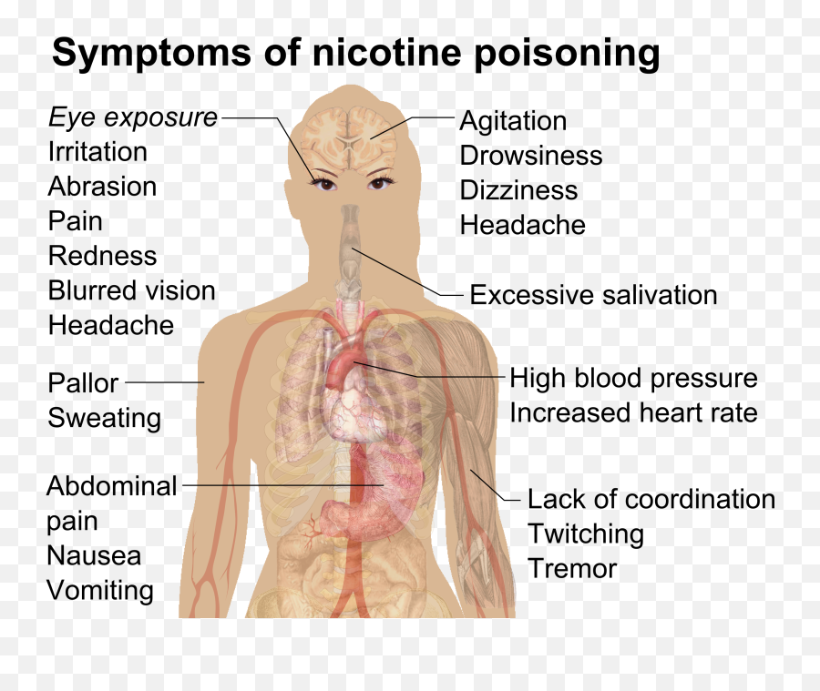 Filesymptoms Of Nicotine Poisoningpng - Wikimedia Commons Nicotine Poisoning,Cigarettes Png