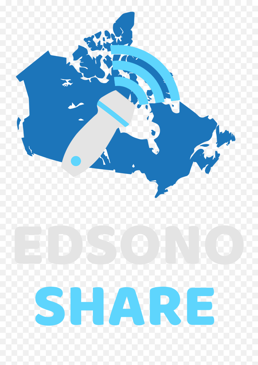 Work In Progress U2013 Edsonoshare - Wollaston Lake Canada Map Png,Work In Progress Png