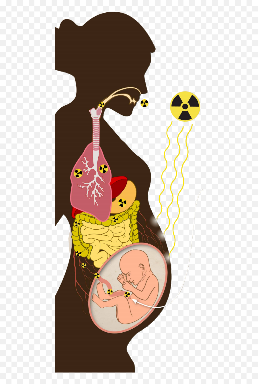 Radiation Emergencies And Pregnancy Chemicals - Radiation Pregnancy Png,Pregnancy Icon Vector