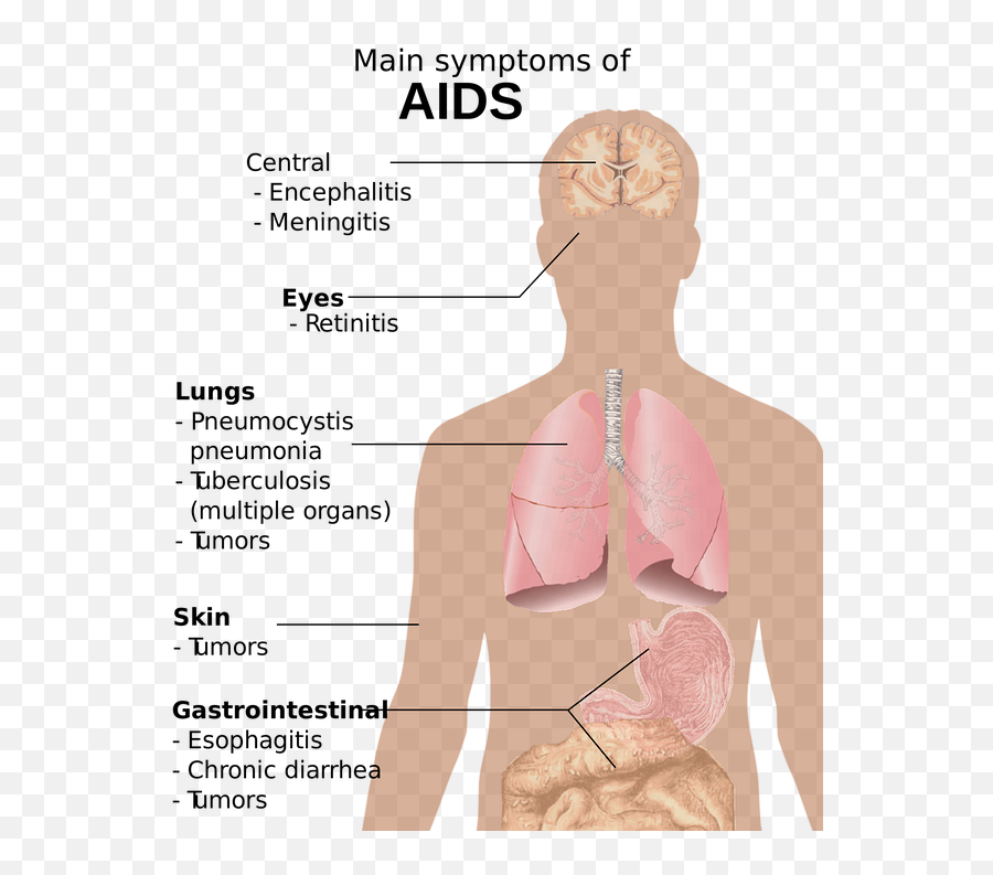 Hiv Aids Png 2 - Hiv Aids Symptoms,Body Png