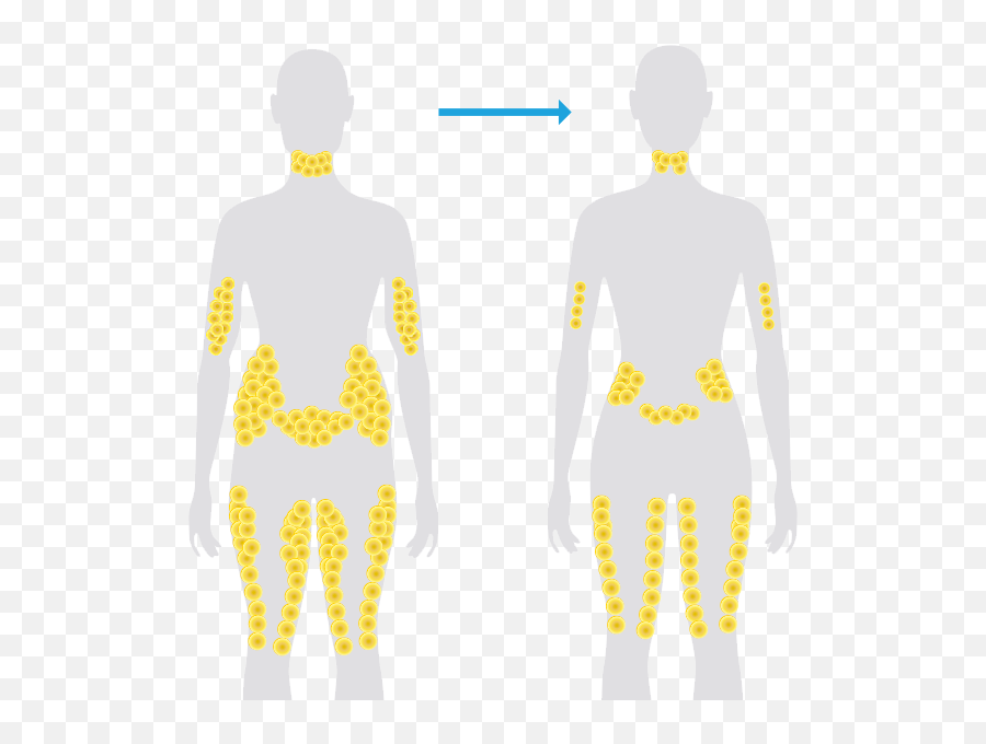 Fat Man Png - Fat Cells In The Body,Fat Man Png