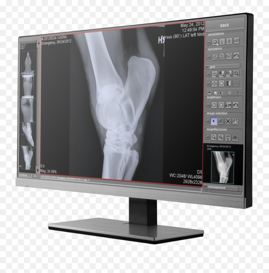Veterinary X - Ray Software U2014 Digital Xray Equipment Nuon Digital X Ray Acquisition Png,X Ray Png
