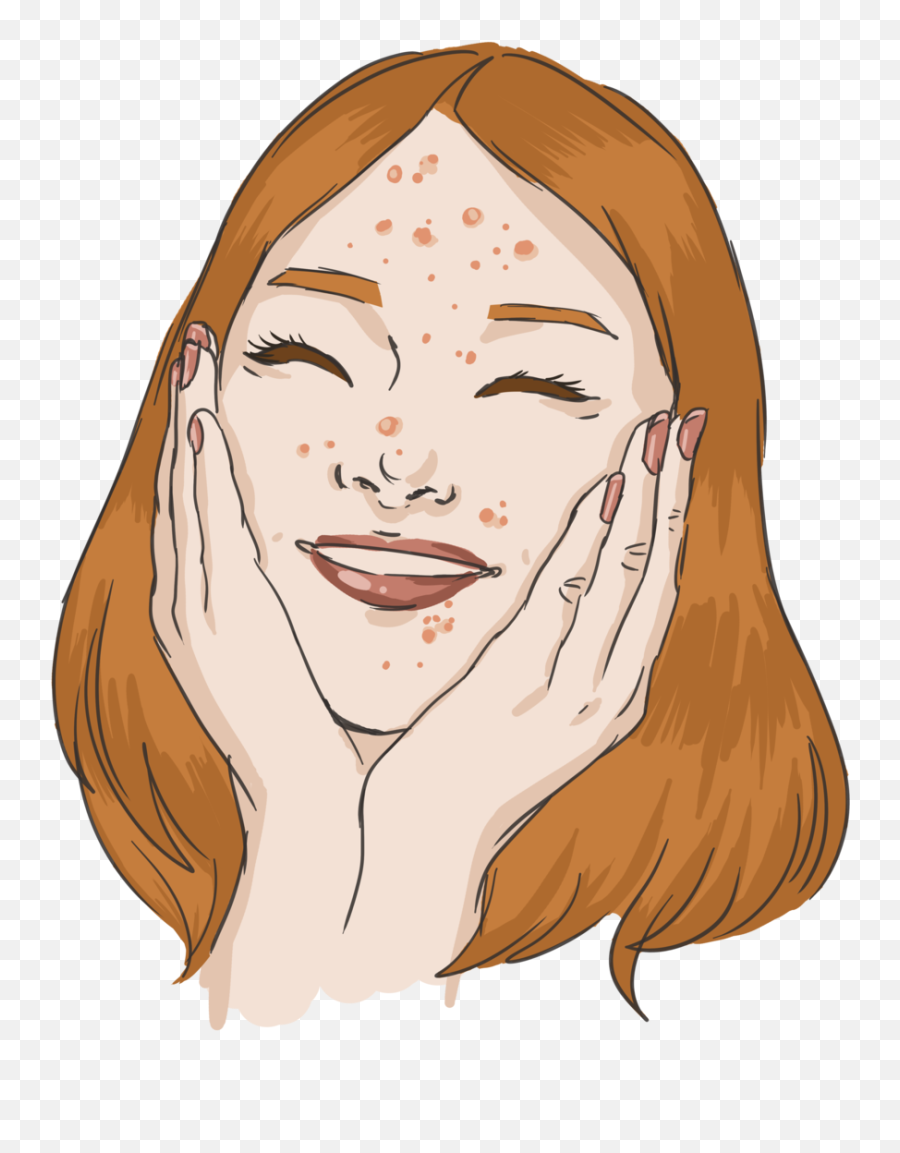 Your Pimples Are Cute U2014 Mag - Acne Clipart Png,Cute Face Png