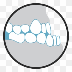 Orthodontic Conditions We Treat To Fix Your Bite - SMILE HOUZZ Language png