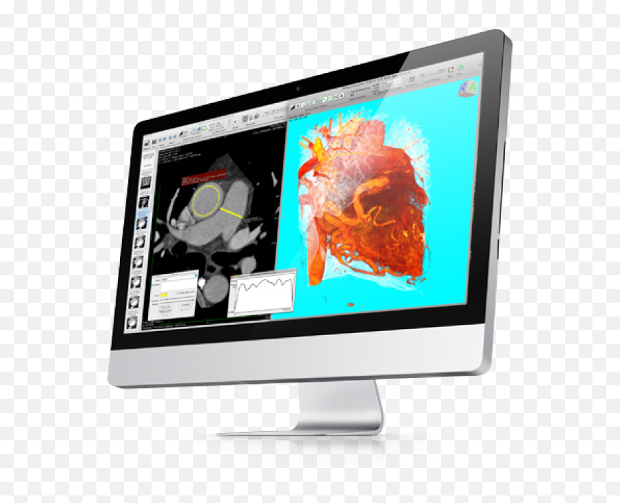 Osirix Dicom Viewer Md - P2 Excalibur Png,3d My Computer Icon