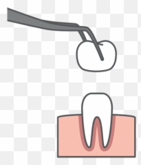 Cosmetic Dentistry In Highlands Ranch Co - Twiss Dental Implant Cartoon png