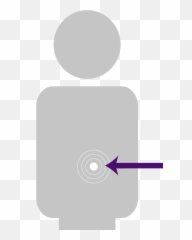 Pancreatic Cancer Risk Factors - Dot png