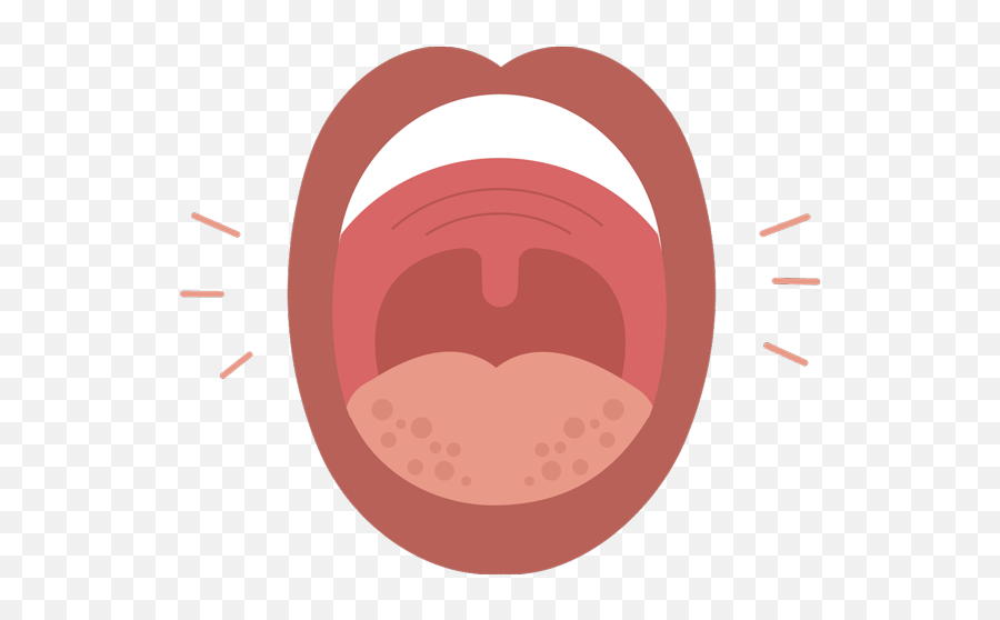 Swollen Mouth 7 Reasons For Swelling Buoy Png Icon