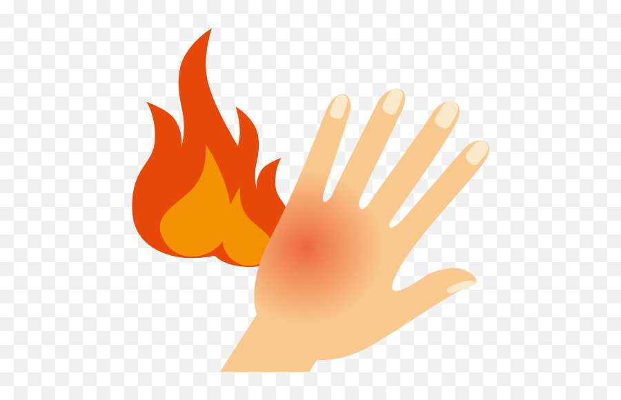 Skin Clipart Burned Food - Burn Clipart Png,Burn Png