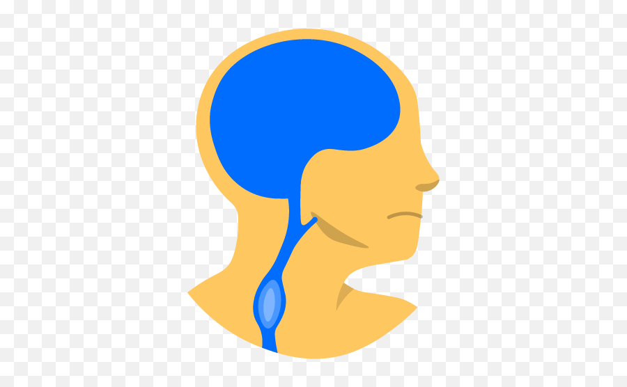 Carotid Artery Dissection - Stroke Carotid Artery Dissection Png,Icon Someone Yelling Their Head Off