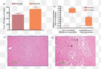 A Elevation In Liver Triglyceride Tg Levels By Dietary - Screenshot Png,Liver Png