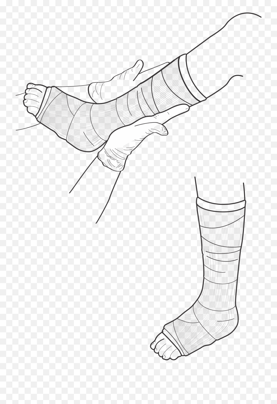 Broken Leg Drawing - Drawing Of Broken Leg Png,Leg Transparent