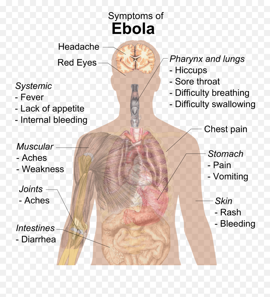 Filesymptoms Of Ebolapng - Wikimedia Commons Disease Of Respiratory System,Could Png